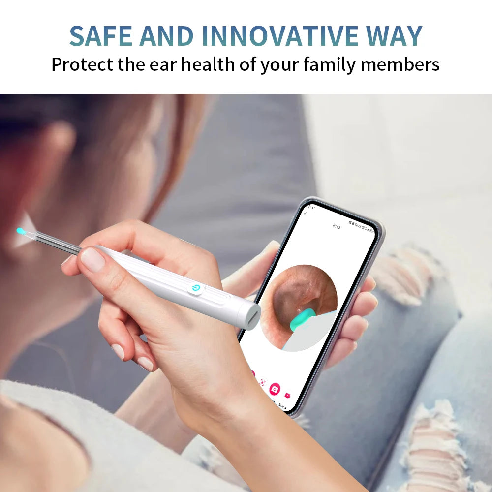 AURACLE: Smart Visual Ear Otoscope (1296P HD)