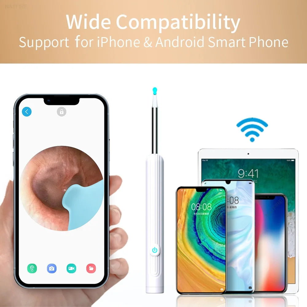 AURACLE: Smart Visual Ear Otoscope (1296P HD)