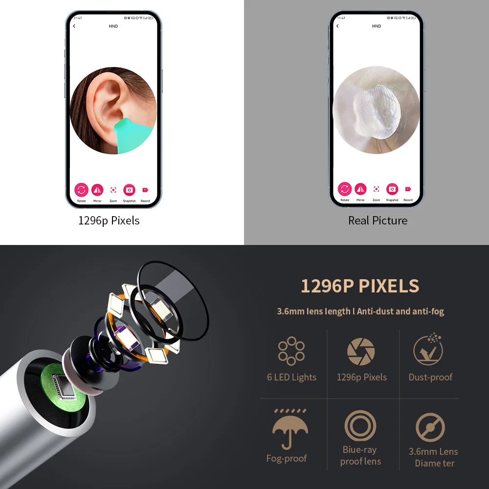 AURACLE: Smart Visual Ear Otoscope (1296P HD)