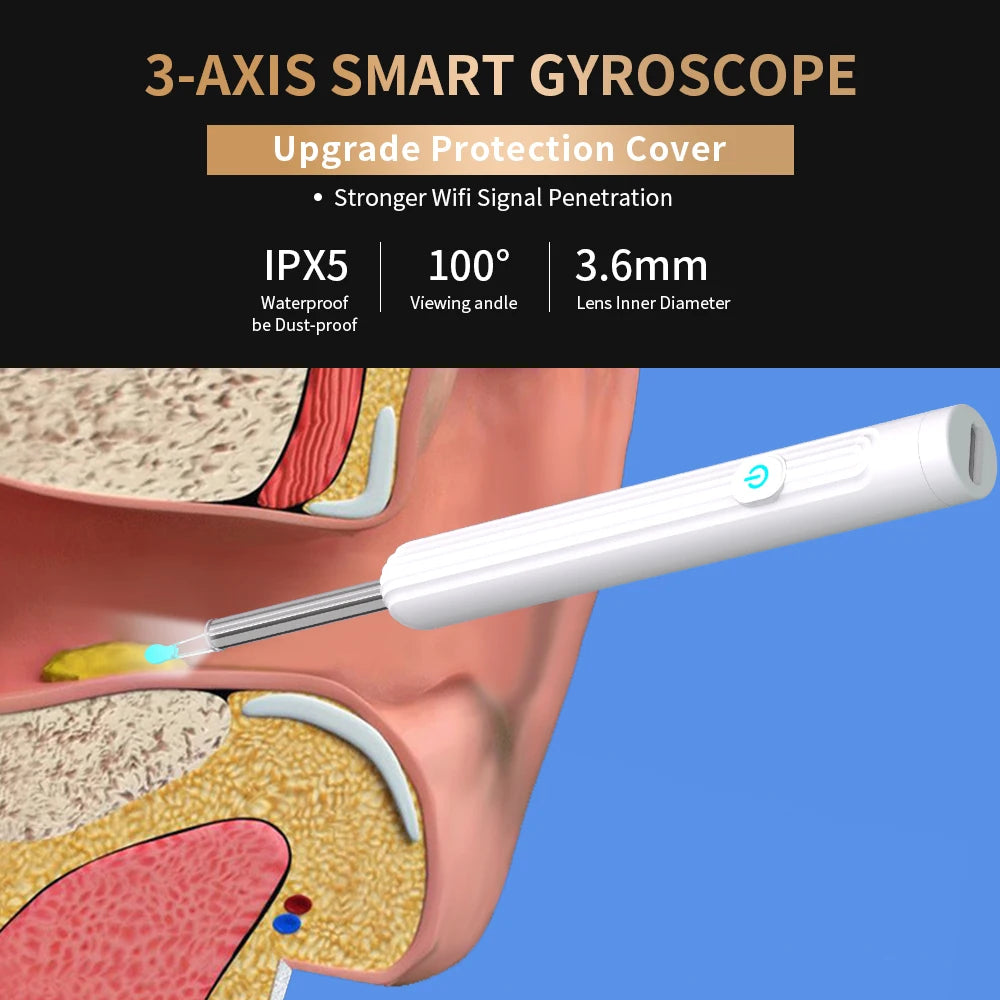 AURACLE: Smart Visual Ear Otoscope (1296P HD)